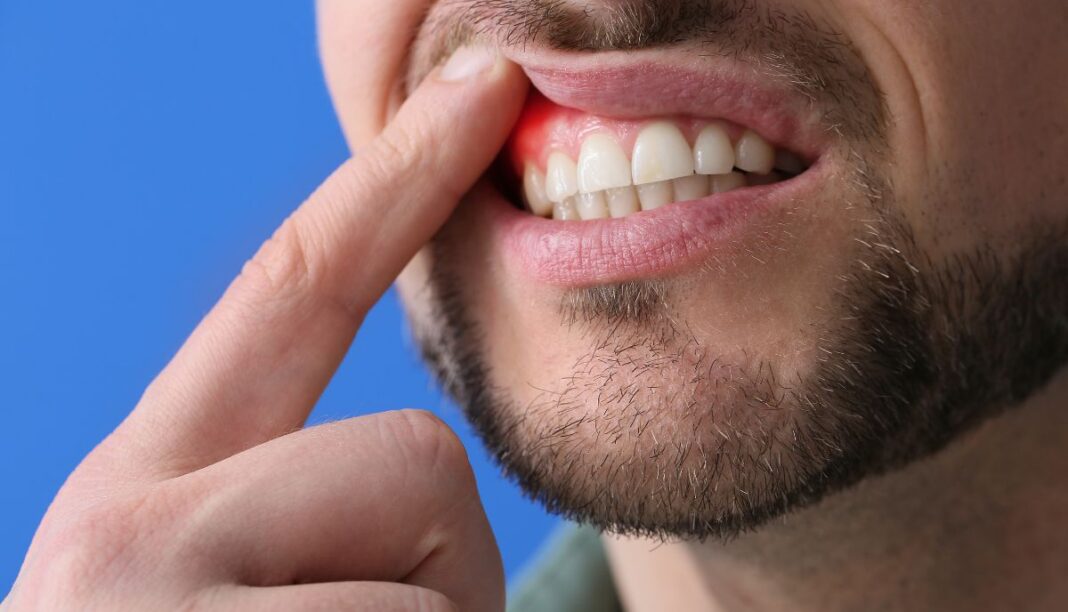 Can Bad Teeth Cause Health Problems?
